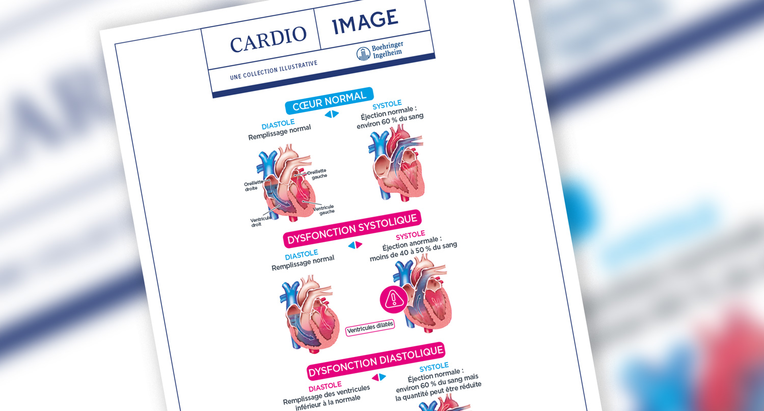 Planche n°4 : Anomalies de remplissage et d’éjection cardiaques