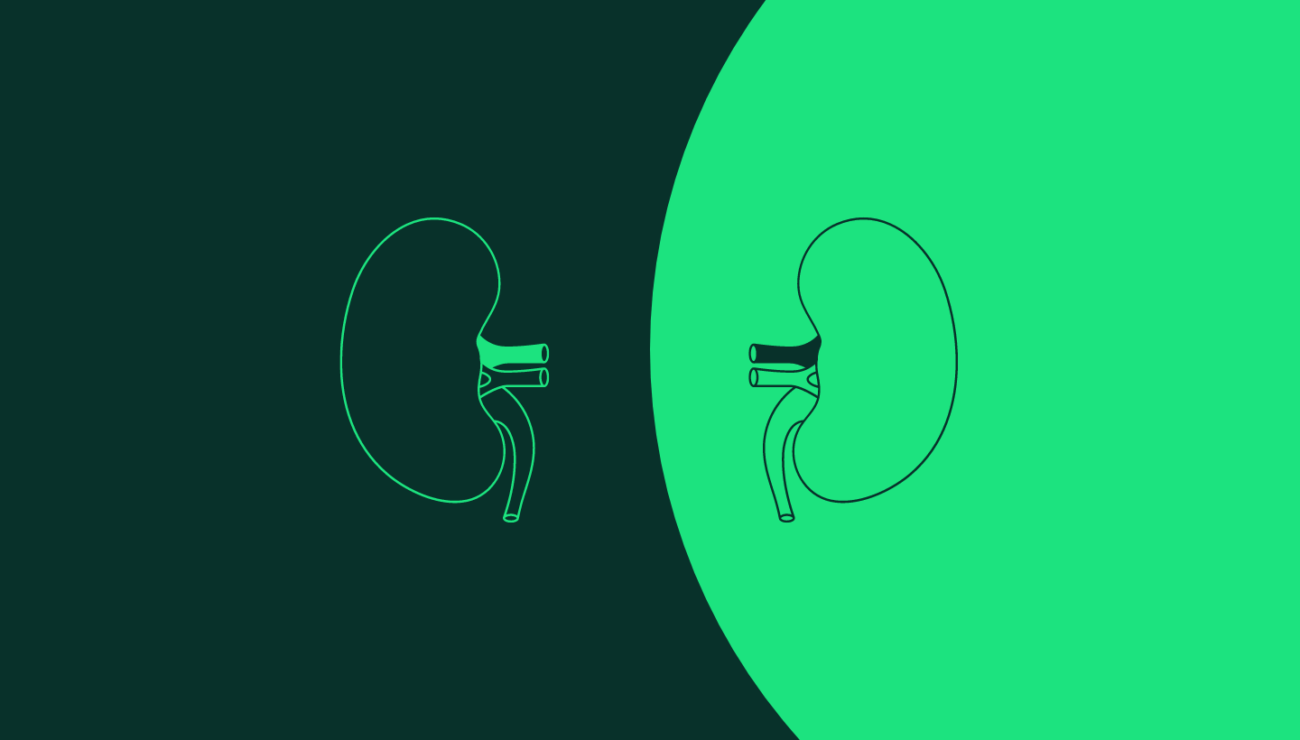 Illustration CRM Protection